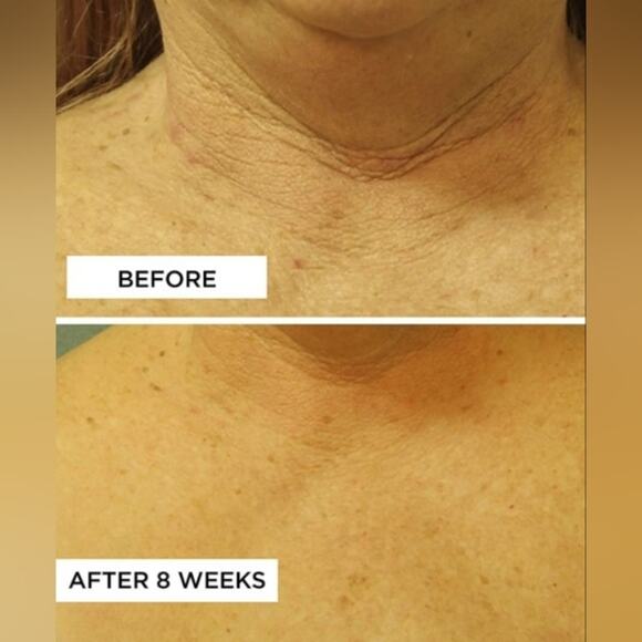 PERRICONE MD Cold Plasma+ Neck and Chest Broad Spectrum SPF 25 1 oz. NEW - Picture 11 of 13